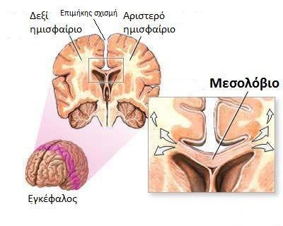 Η διασύνδεση - Τα δύο εγκεφαλικά ημισφαίρια συνδέονται με το μεσολόβιο.